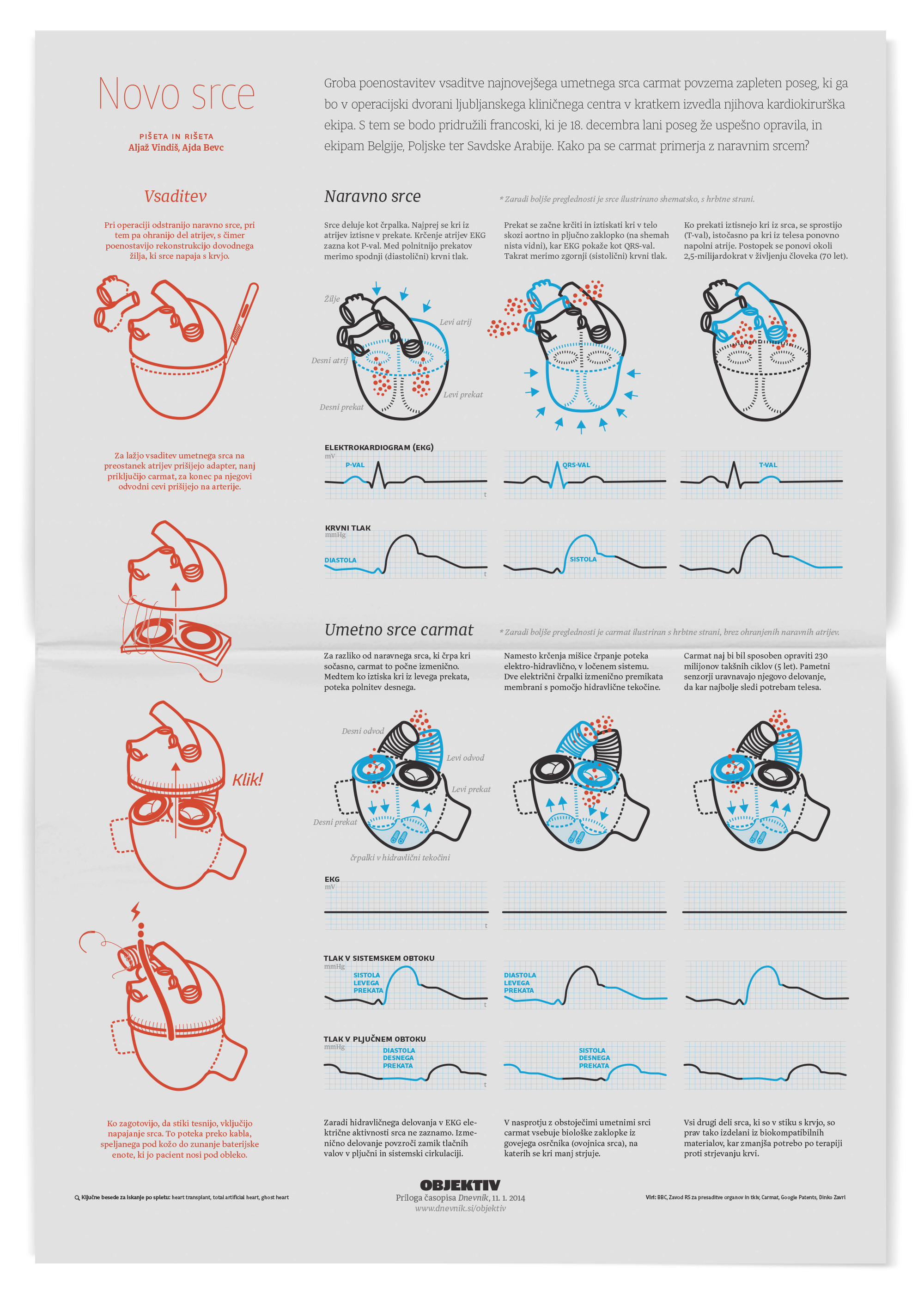 Illustration of Carmat artificial heart.